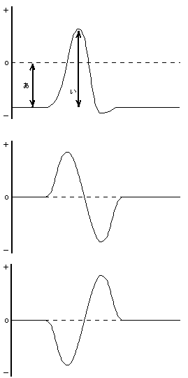 膜電位グラフ(1)